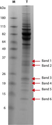 Trypanosoma equiperdum Low Molecular Weight Proteins As Candidates for Specific Serological Diagnosis of Dourine